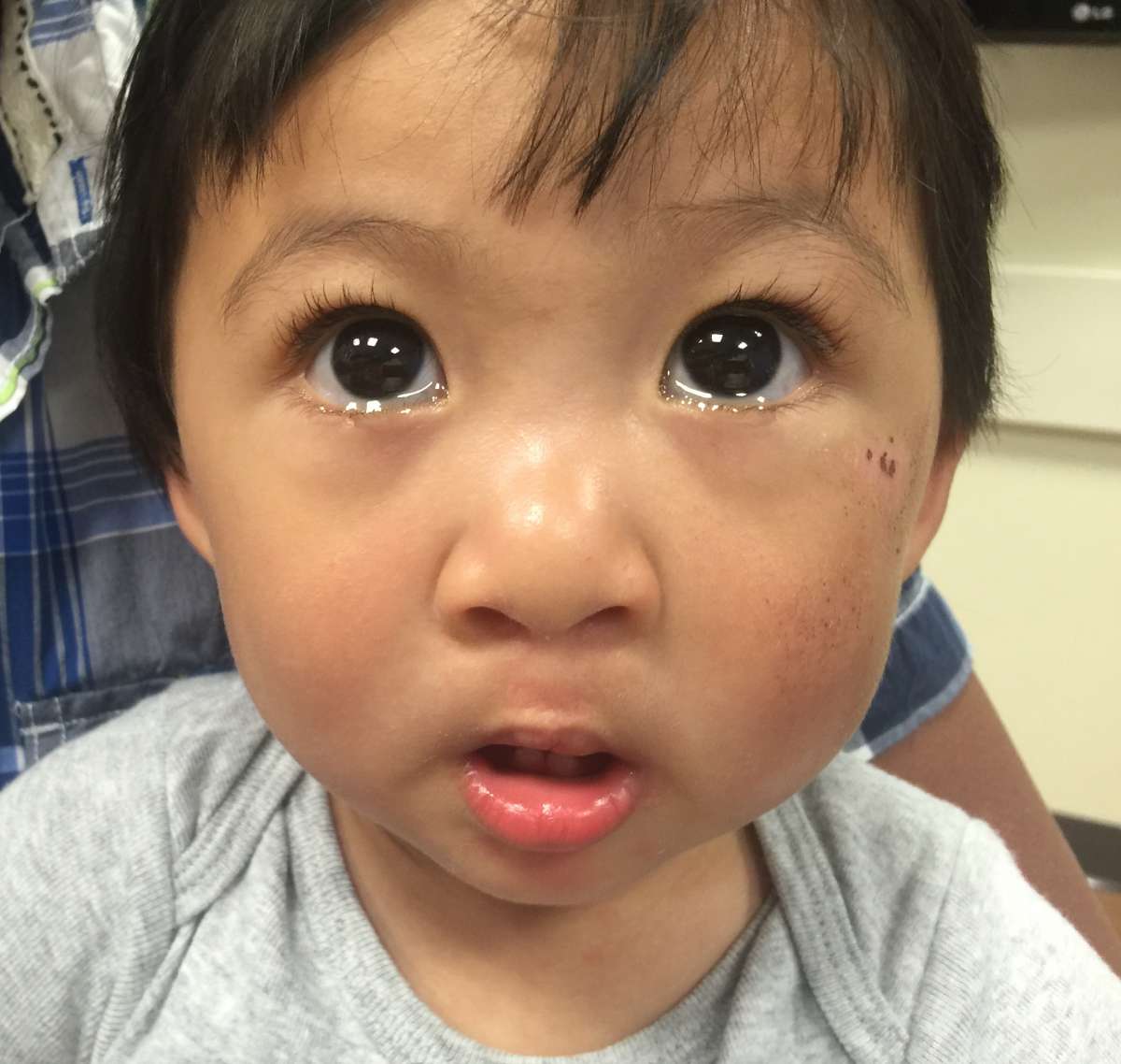 Dr. Bastidas works with a team at the Center of Excellence for Cleft Lip & Palate delivering cleft defect solutions.