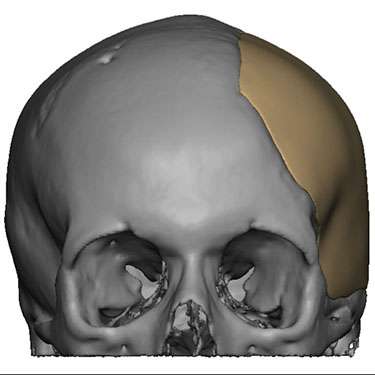 Patients undergoing craniofacial surgery with Dr. Bastidas benefit with the advantage of reconstructive care from a team of multidisciplinary physicians.