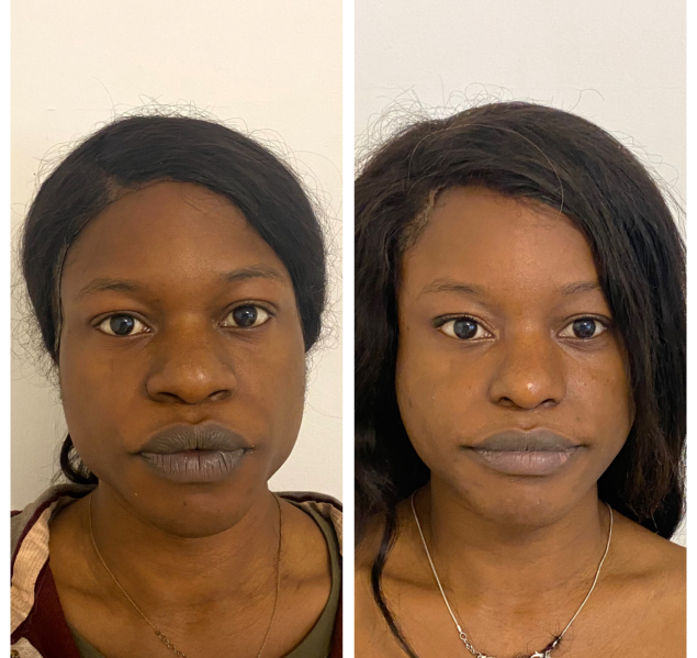 Enhancing Beauty: Transformative Cosmetic Procedures